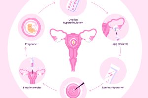 Frozen Embryo Transfer (FET)